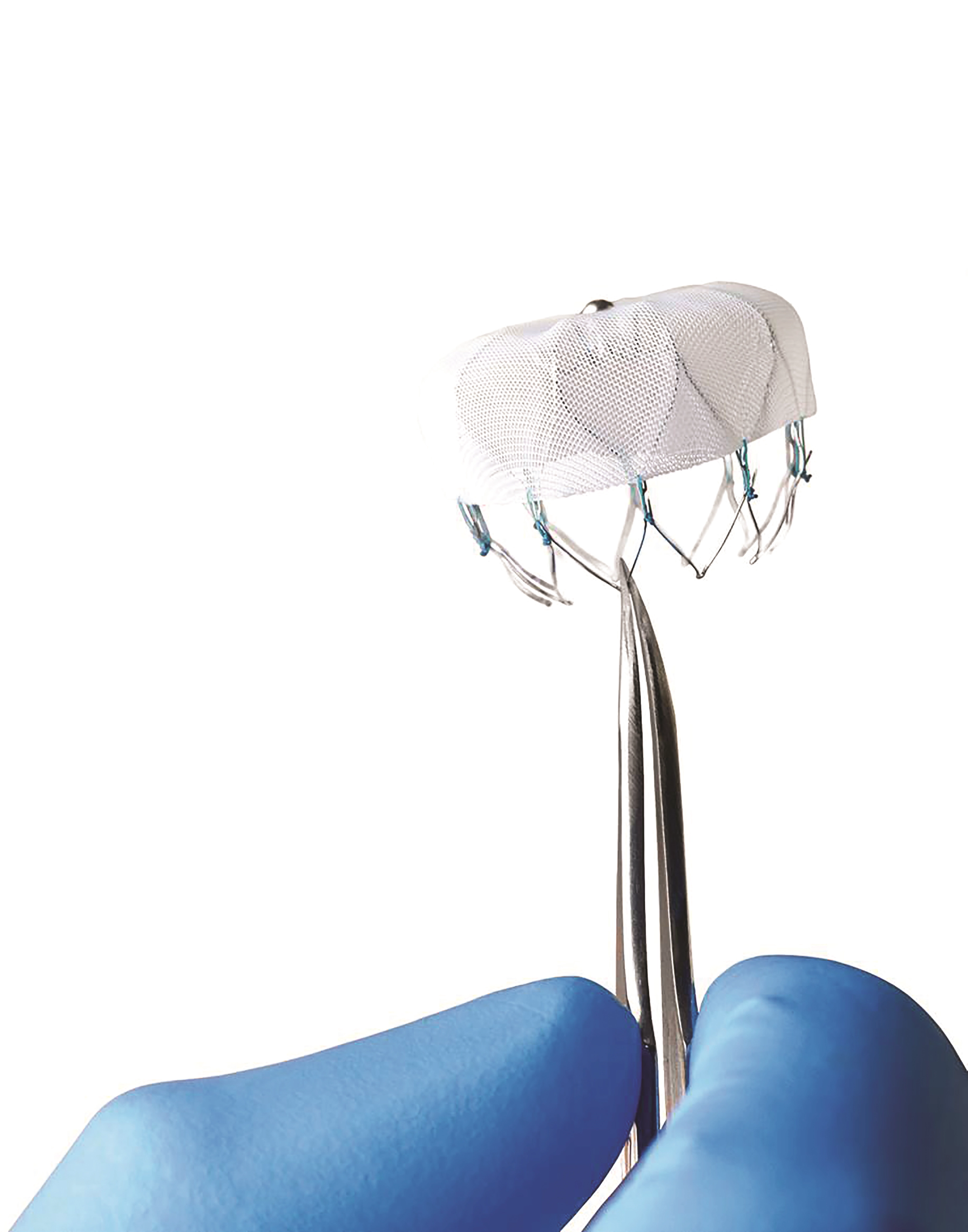 Watchman Device | Heart | Salem Health