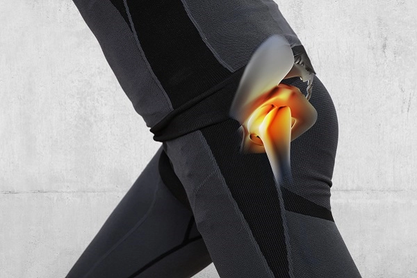 photo illustration of pain radiating from hip bone joints