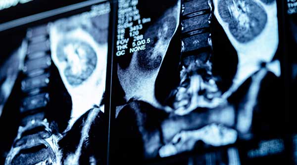 Spinal x-ray