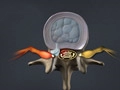 herniateddisc_120