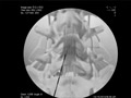 lumepisteroid_120