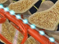stimimplant_120