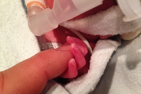 MOD NICU tiny hand